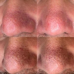 Intraceuticals