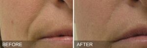Intraceuticals