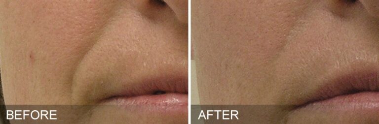 Hydrafacial București – curățare facială profundă și hidratare intensă Hydrafacial București – curățare facială profundă și hidratare intensă