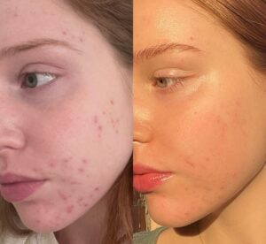 Intraceuticals