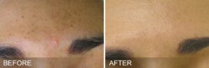 Intraceuticals