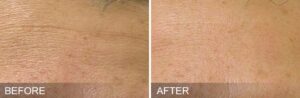 Intraceuticals