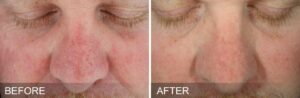 Intraceuticals