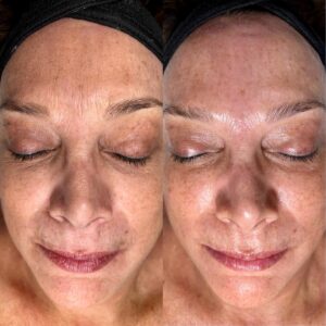 Intraceuticals