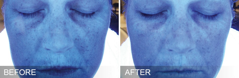 Intraceuticals