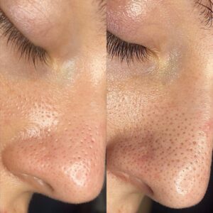 Intraceuticals