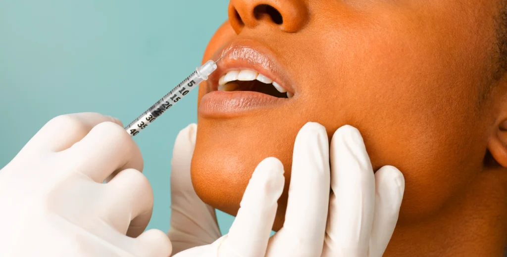 Cât costă să îți pui acid hialuronic în buze la Dr. Harnagea?