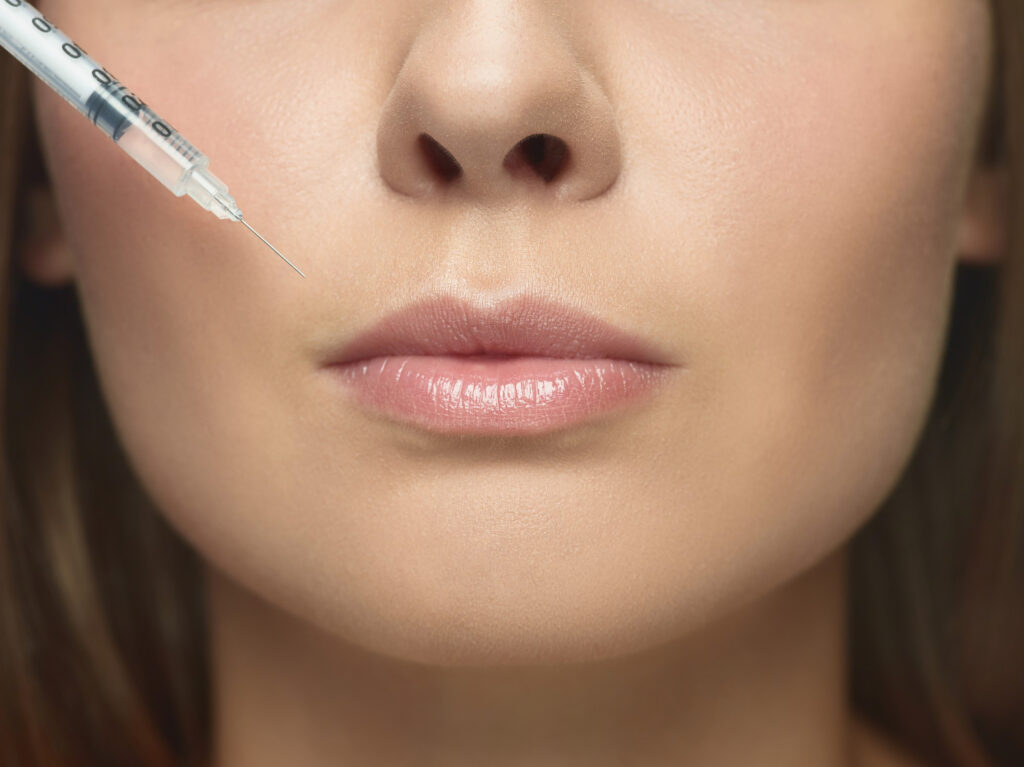 acid hialuronic în buze