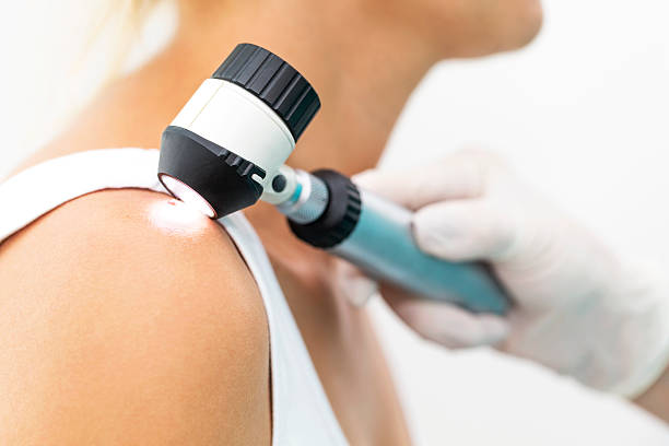Consultatii Dermatologice