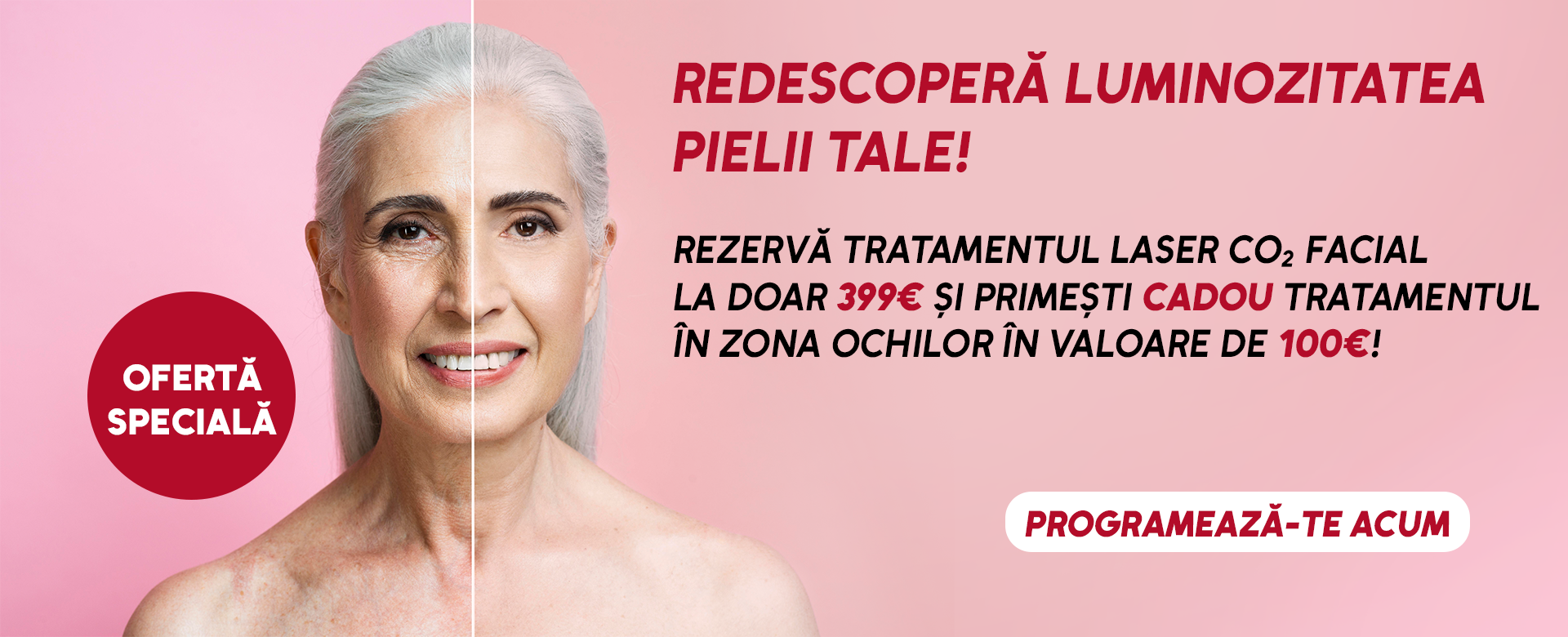 Tratamentul cu laser CO2 Candela pentru rejuvenare  facială