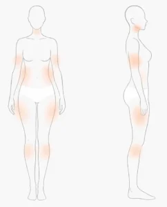 NuEra&reg; Tight &icirc;n București &ndash; tratament pentru fermitate, celulită și remodelare corporală