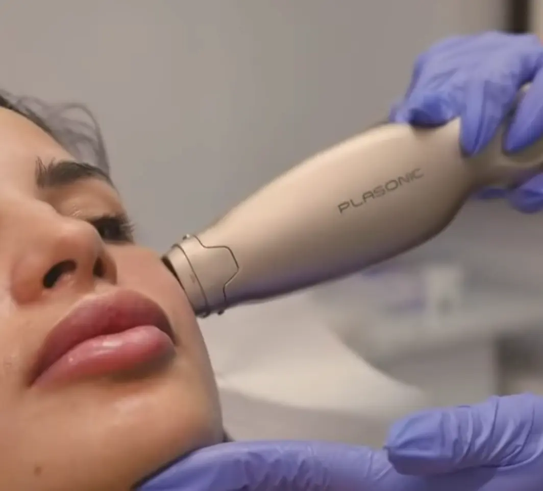 Mezoterapie Facială - Hidratare, Luminozitate și Revitalizarea Tenului